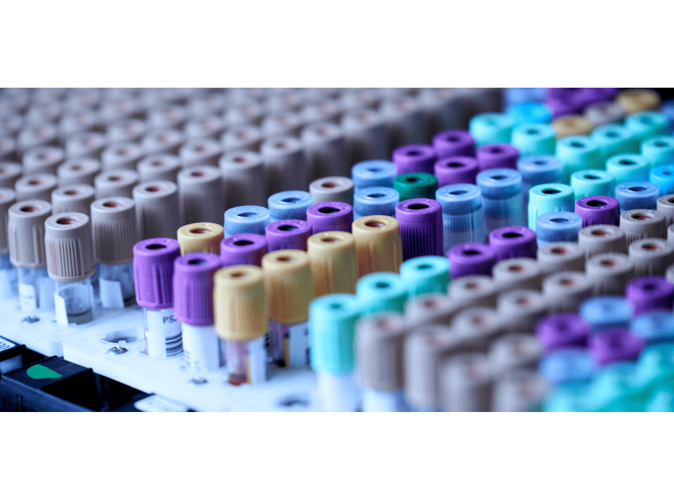 test zakisanosti organizma